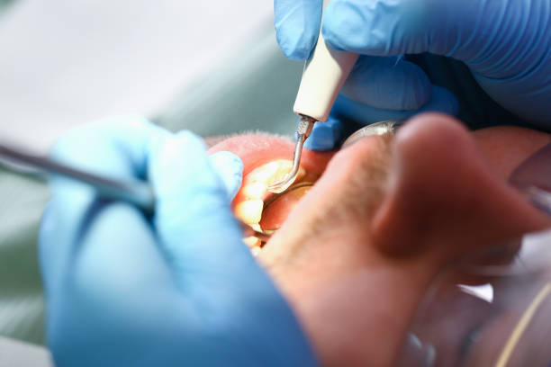 Best Knocked-Out Tooth Emergency  in , MS