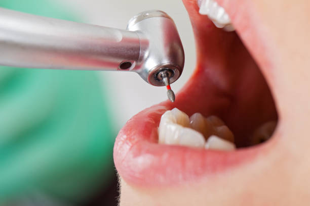 Best Chipped Tooth Repair Near Me  in , MS